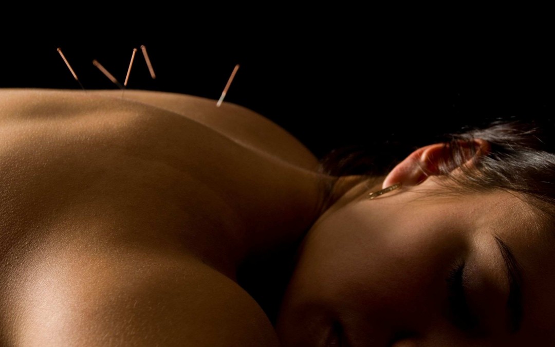 “La acupuntura está muy reconocida en países como Inglaterra o Francia”