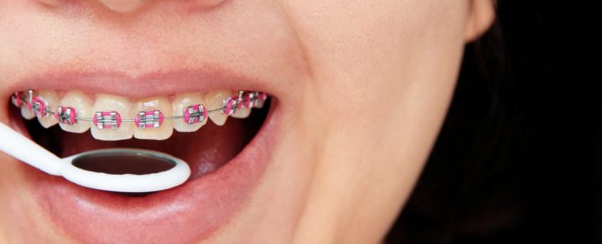 La higiene bucodental en la ortodoncia