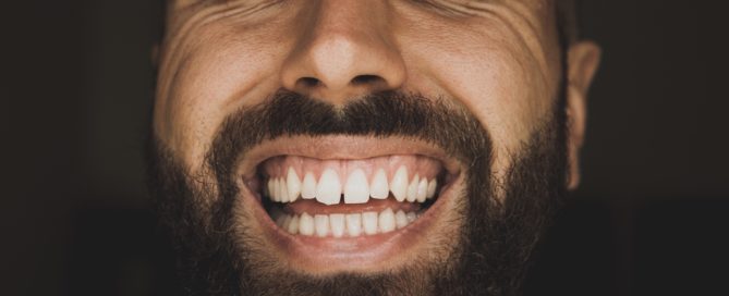 Cómo solucionar los espacios entre dientes